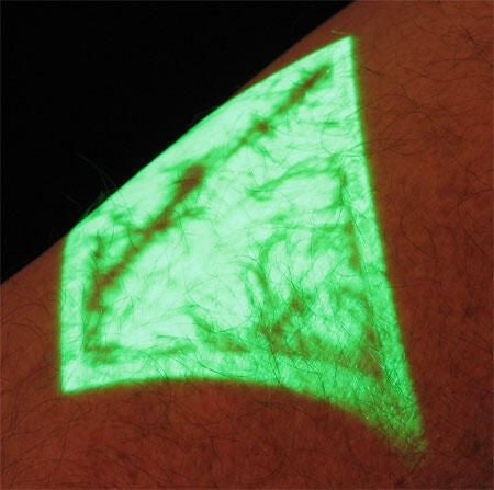 Veins projected on arm